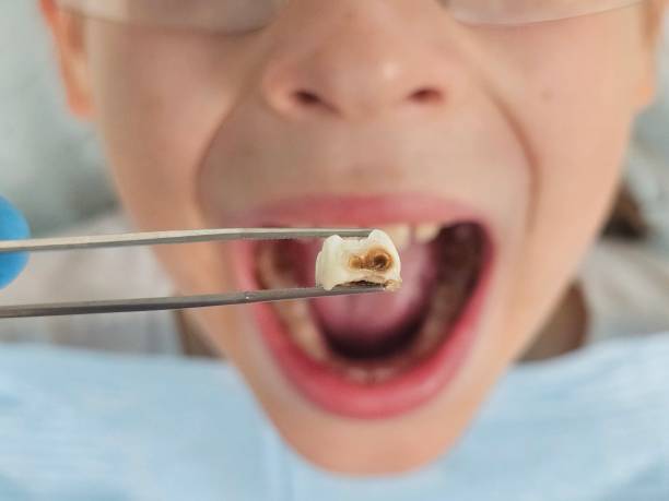Best Emergency Dental Care for Sports Injuries in Vista Center, NJ